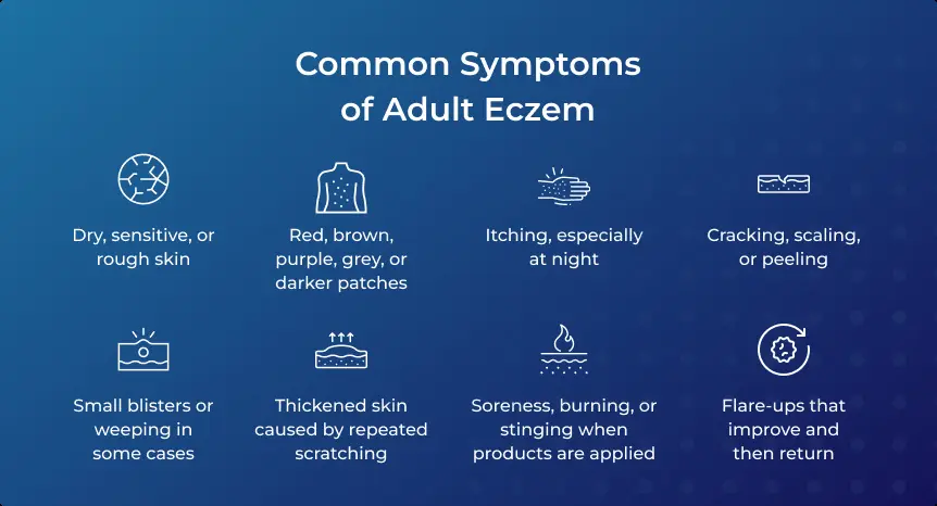 Common Symptoms of Adult Eczema