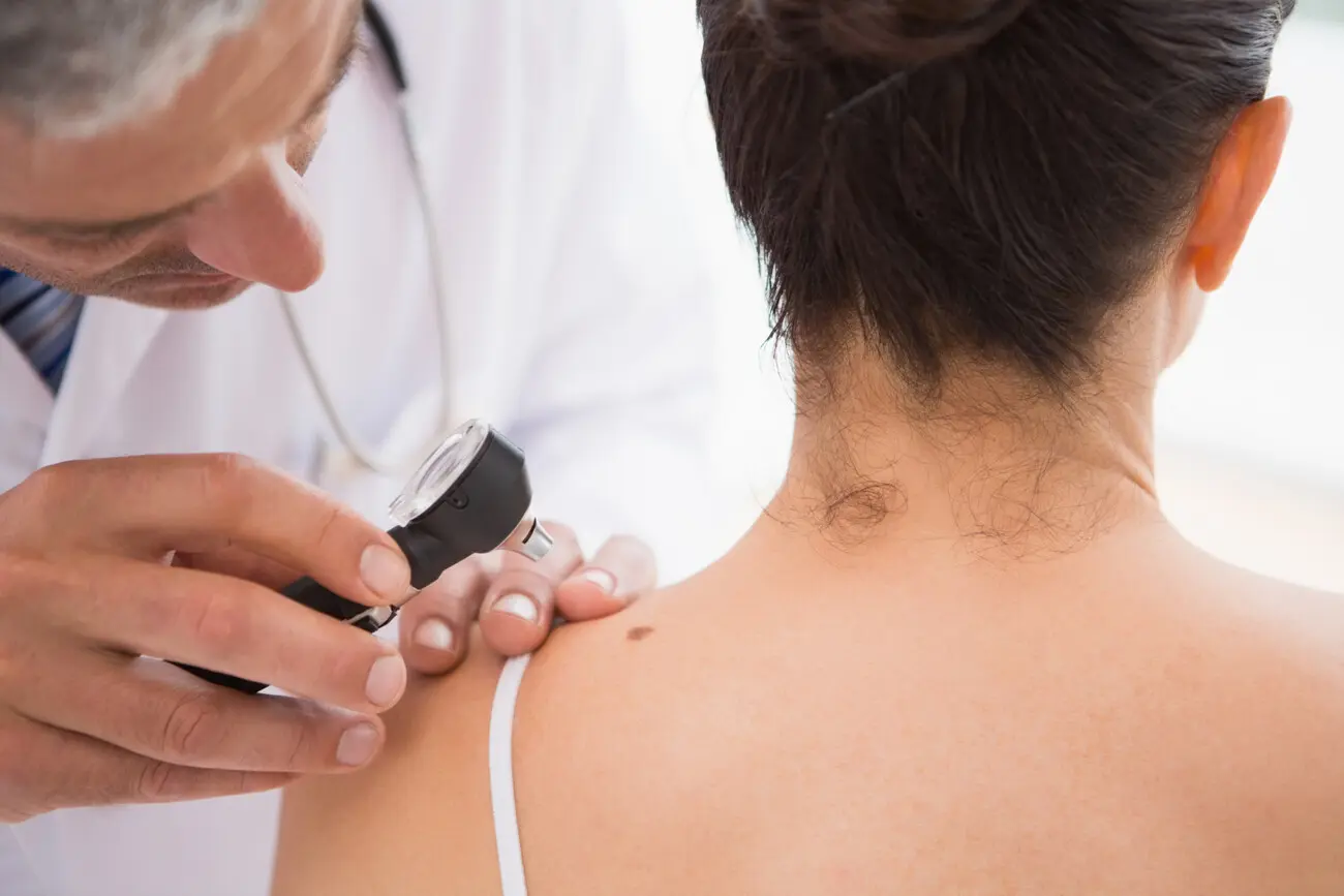 Skin Cancer and Mole Checks