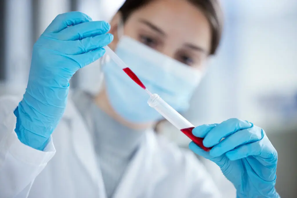How Graves’ Disease Is Diagnosed