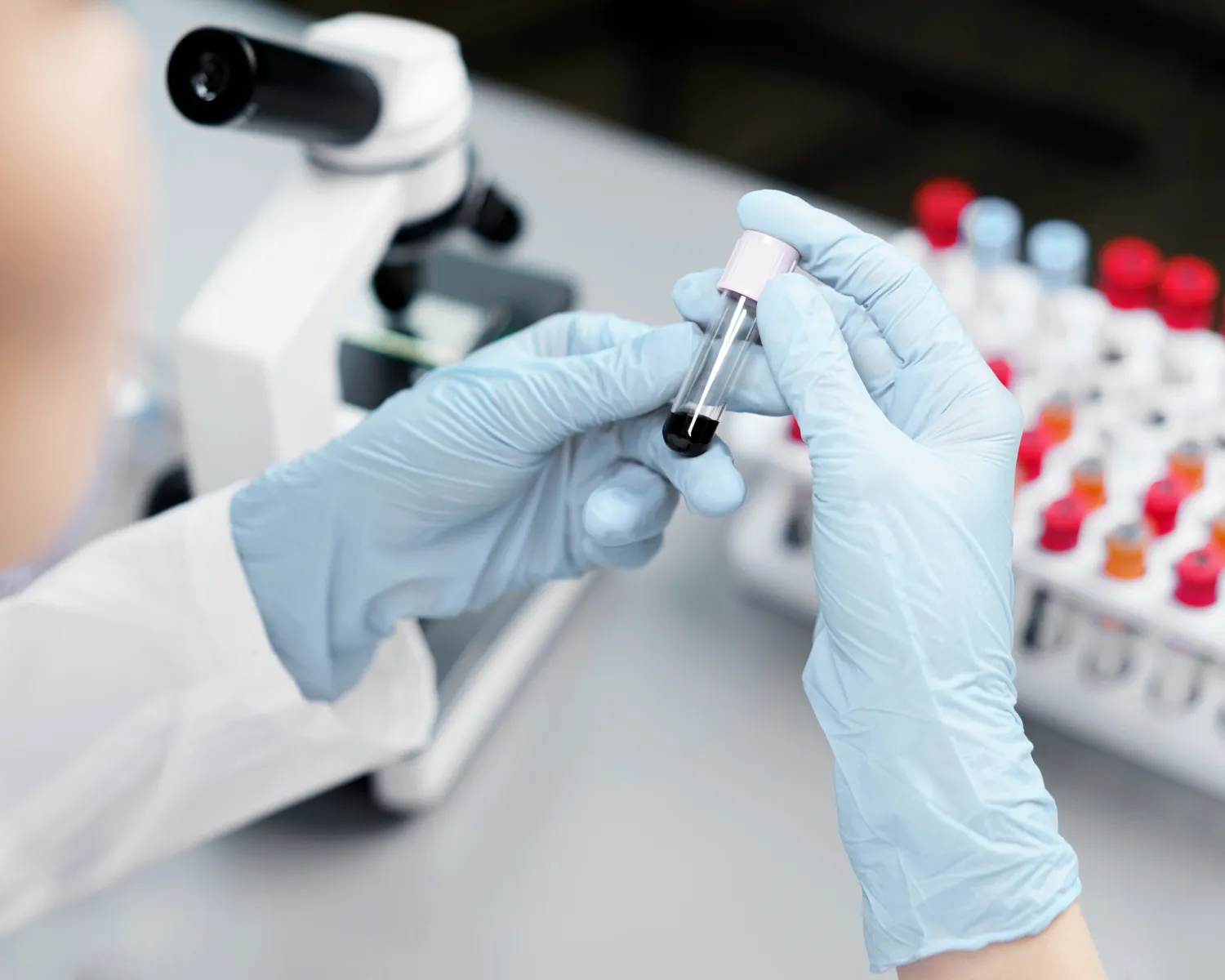 What Does a TSH Blood Test Measure